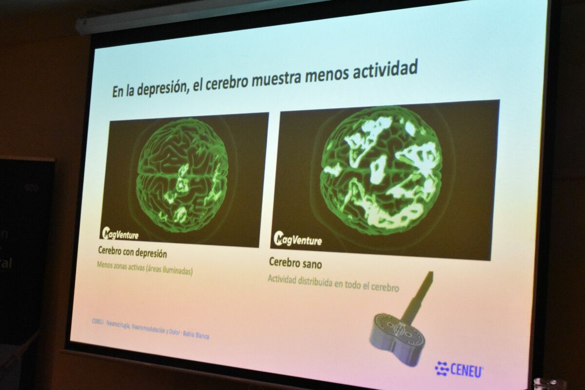 Imagen del artículo